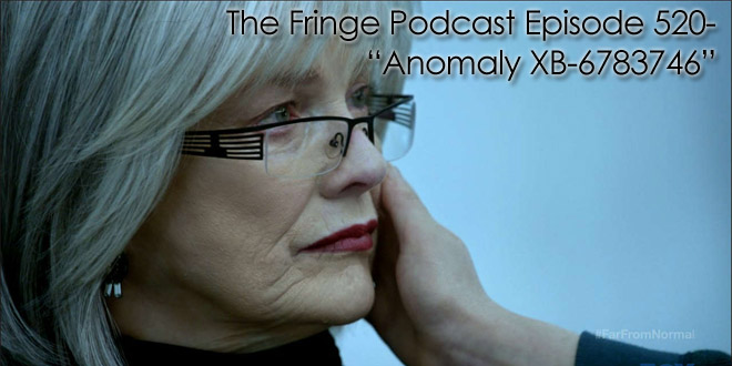 TFP 520-Anomaly XB-6783746